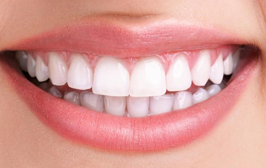Best-Hollywood-Smile-Design-Dubai.jpg