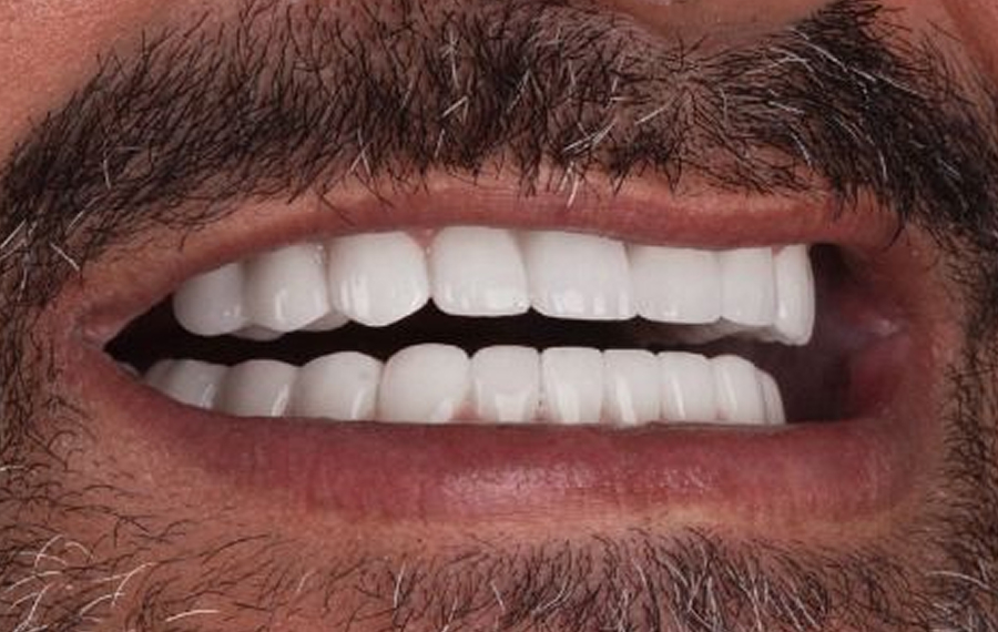 Best-Tooth-Extraction-Dubai.jpg
