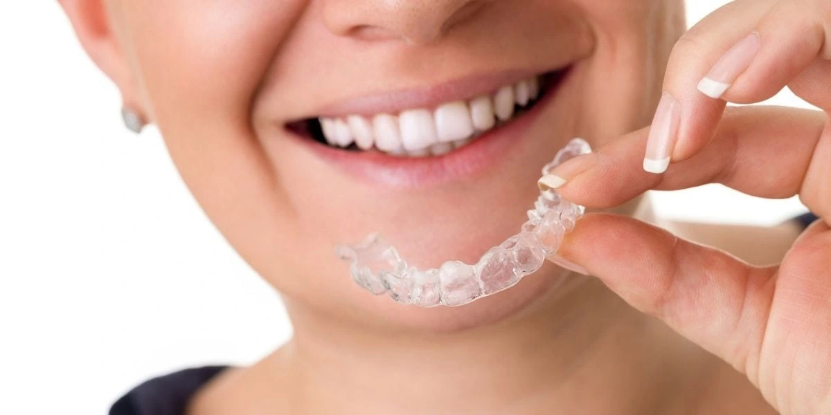 Teeth Alignment Or Straightening Know The Difference (1)