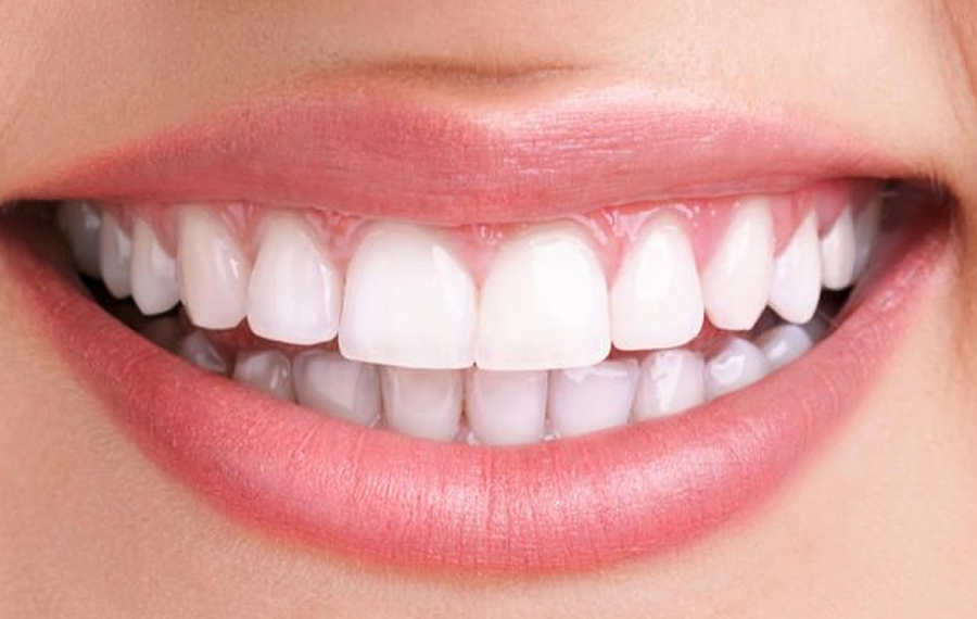 Zoom-Teeth-Whitening-Dubai.jpg