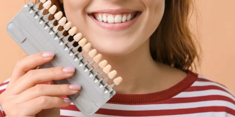 هل تحتاج الفينيرز للأسنان إلى الكثير من الصيانة؟
