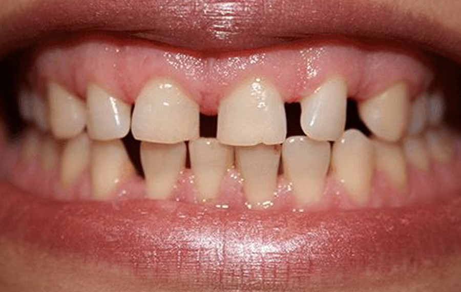 Best Dental X Ray Dubai.jpg Best Dental X Ray Dubai.jpg