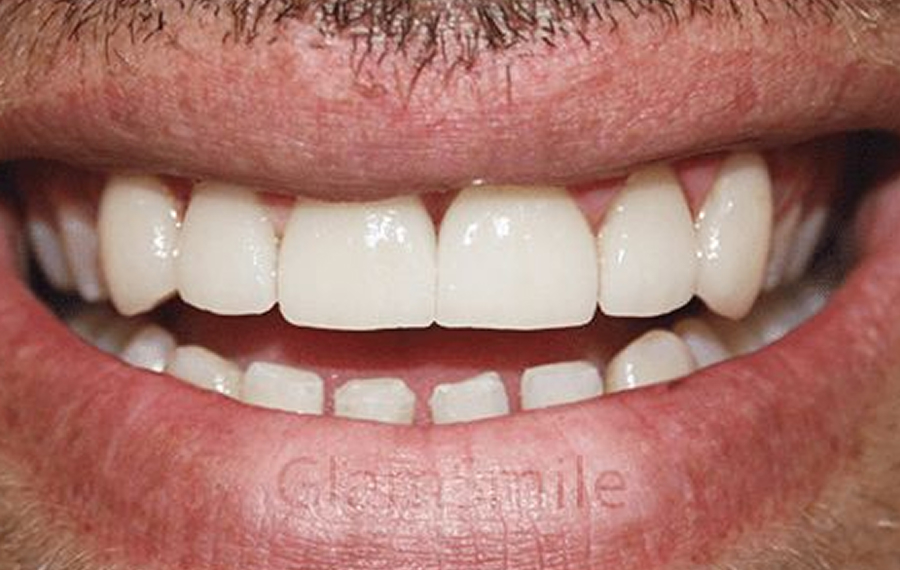 Best Dental X Ray in Dubai.jpg