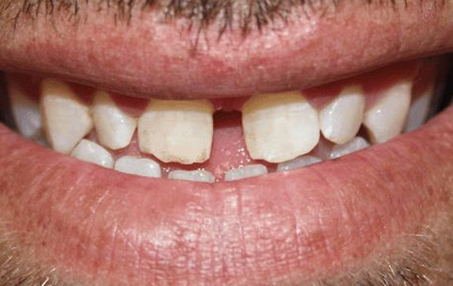 Best Dental X Ray.jpg Best Dental X Ray.jpg