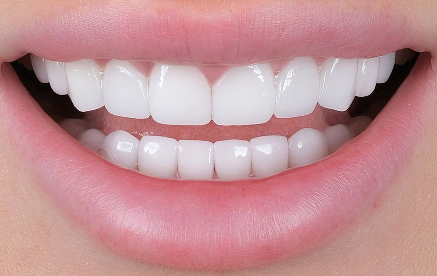 Dental Stains Removal in Dubai.jpg