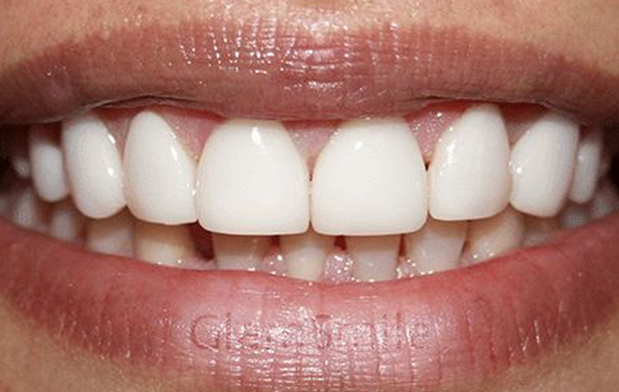 Dental X Ray Dubai.jpg