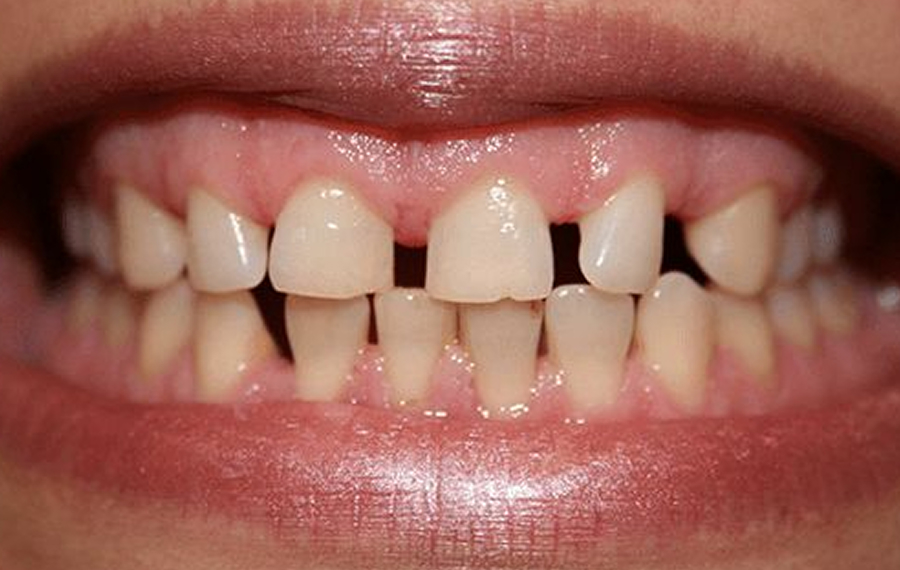 Dental X Ray in Dubai.jpg Dental X Ray in Dubai.jpg