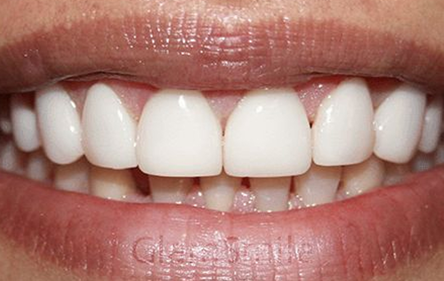 Dental X Ray.jpg