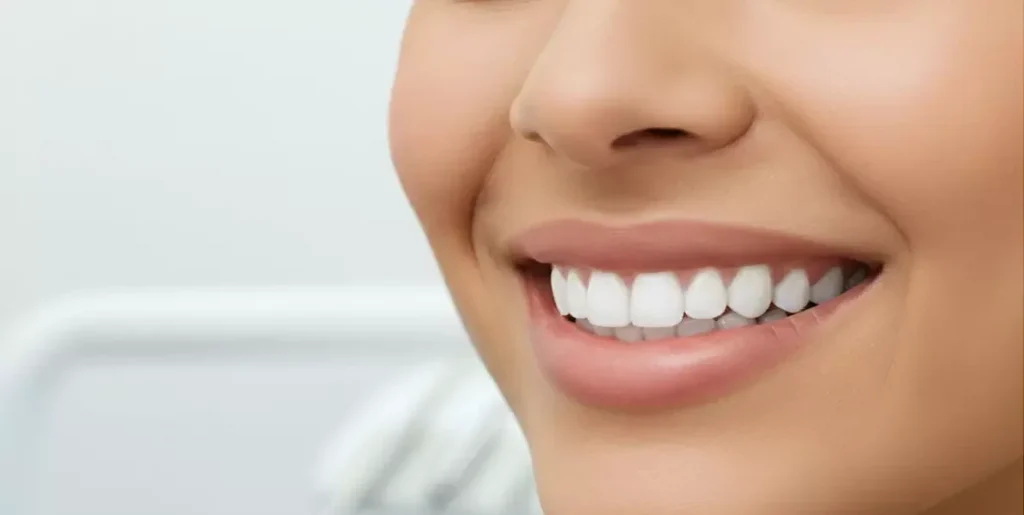تكلفة تنظيف الأسنان في دبي
