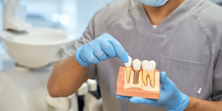 Are Dental Implants Worth It? 5 Are Dental Implants Worth It?
