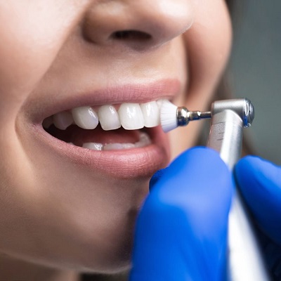 Teeth Cleaning in Dubai