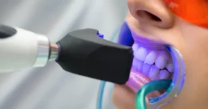 What is the Most Effective Teeth Whitening Method?