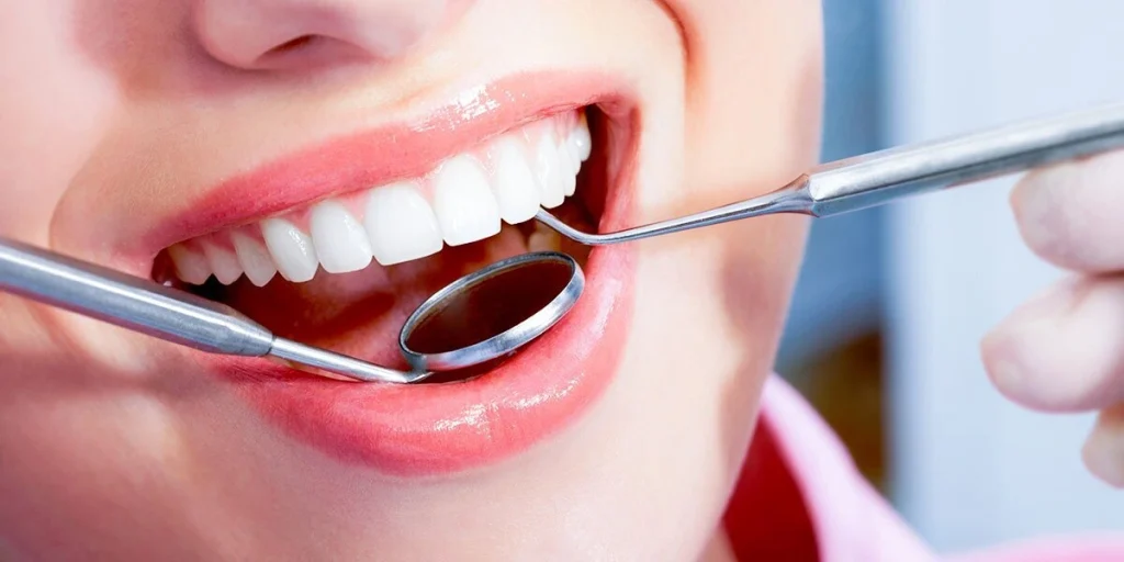 Benefits of Teeth Scaling Is Scaling Good For Teeth