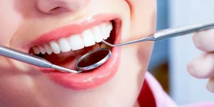 Benefits of Teeth Scaling: Is Scaling Good For Teeth?
