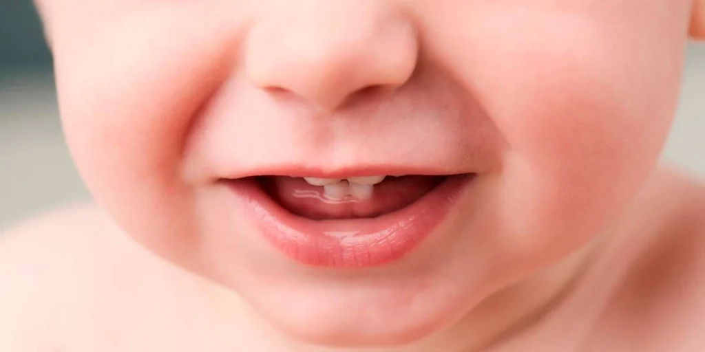 What are the white spots on my baby’s teeth