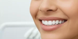 Teeth Cleaning Cost in Dubai