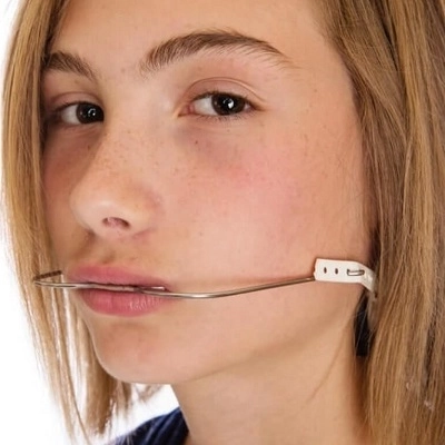 Dental Headgear Cost in Dubai (1)