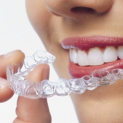 Teeth Aligners Cost in Dubai